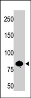 PAB3997 - PFKL