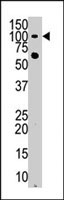 PAB4001 - Hexokinase-3