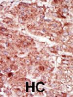 PAB4001 - Hexokinase-3