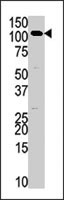 PAB4002 - Hexokinase-3