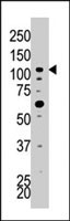 PAB4004 - Hexokinase-2