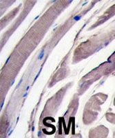 PAB4004 - Hexokinase-2