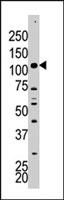 PAB4005 - Hexokinase-2