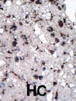PAB4005 - Hexokinase-2