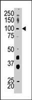 PAB4008 - Hexokinase-1