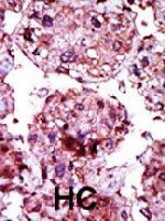 PAB4008 - Hexokinase-1