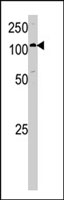 PAB4009 - Hexokinase-1