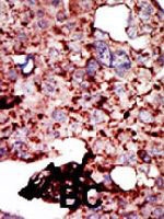 PAB4009 - Hexokinase-1