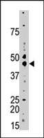PAB4015 - Casein kinase II subunit alpha