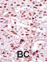 PAB4015 - Casein kinase II subunit alpha