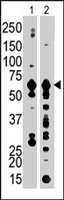PAB4017 - PFKFB3