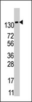 PAB4018 - PFKFB2