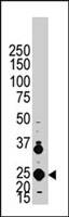 PAB4025 - FGF4