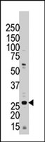 PAB4027 - 14-3-3 protein zeta/delta