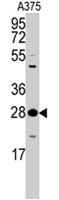 PAB4028 - 14-3-3 protein zeta/delta
