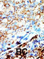 PAB4030 - NME4