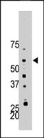 PAB4031 - PFKFB4