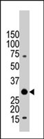 PAB4033 - 14-3-3 protein beta/alpha