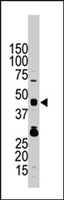 PAB4034 - TRIB3