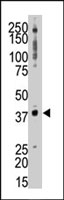 PAB4035 - TRIB3