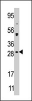PAB4036 - CIB2