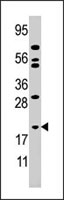 PAB4039 - Adenylate kinase 1 / AK1