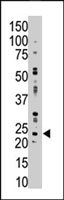 PAB4040 - Adenylate kinase 1 / AK1