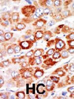 PAB4040 - Adenylate kinase 1 / AK1