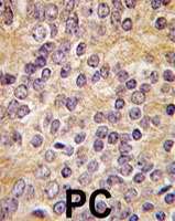 PAB4042 - uPA / PLAU