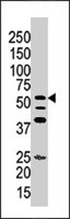 PAB4051 - ITPKA / IP3 3-kinase A