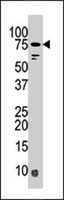 PAB4053 - BRSK1