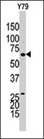 PAB4059 - Guanylate cyclase soluble GUCY1B3