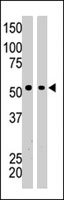 PAB4062 - BAIAP2