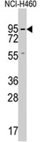 PAB4064 - GCS-alpha-2 / GUCY1A2