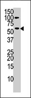 PAB4068 - Choline kinase alpha
