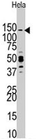 PAB4069 - PIK3CG