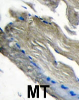 PAB4069 - PIK3CG