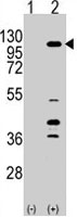 PAB4069 - PIK3CG