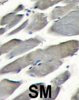 PAB4070 - PIK3CG