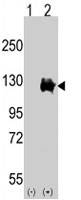 PAB4071 - TRPM8