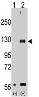 PAB4072 - TRPM8