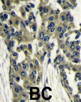 PAB4075 - LST8 / GBL