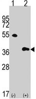 PAB4075 - LST8 / GBL