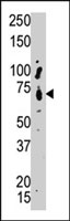 PAB4083 - PTPN9