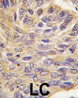PAB4083 - PTPN9