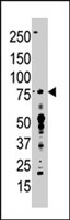 PAB4084 - PTPRR