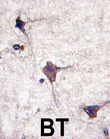 PAB4084 - PTPRR