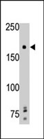 PAB4092 - PTPRG / PTPG