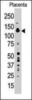 PAB4102 - PTPN21 / PTPD1
