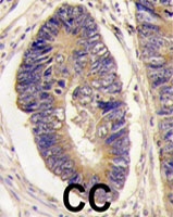 PAB4104 - PTPN3 / PTPH1